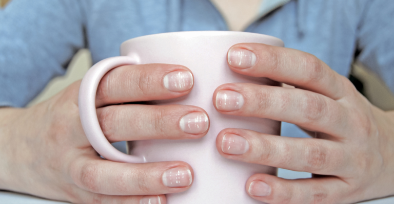 Unhas com Manchas Brancas: O Que Elas Significam e Como Tratar